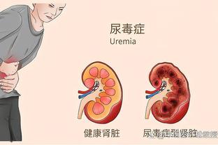 MS只差N❗斯基拉：苏亚雷斯明年1月自由身加盟迈阿密国际❗